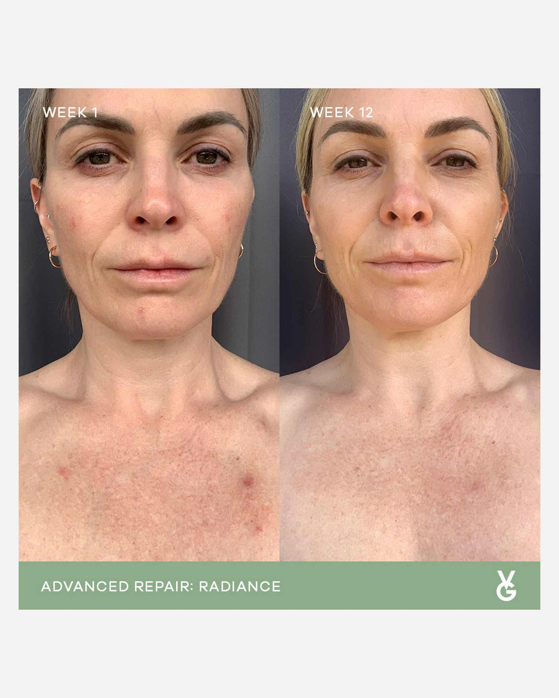 Vida Glow | Radiance Advanced Repair Capsules